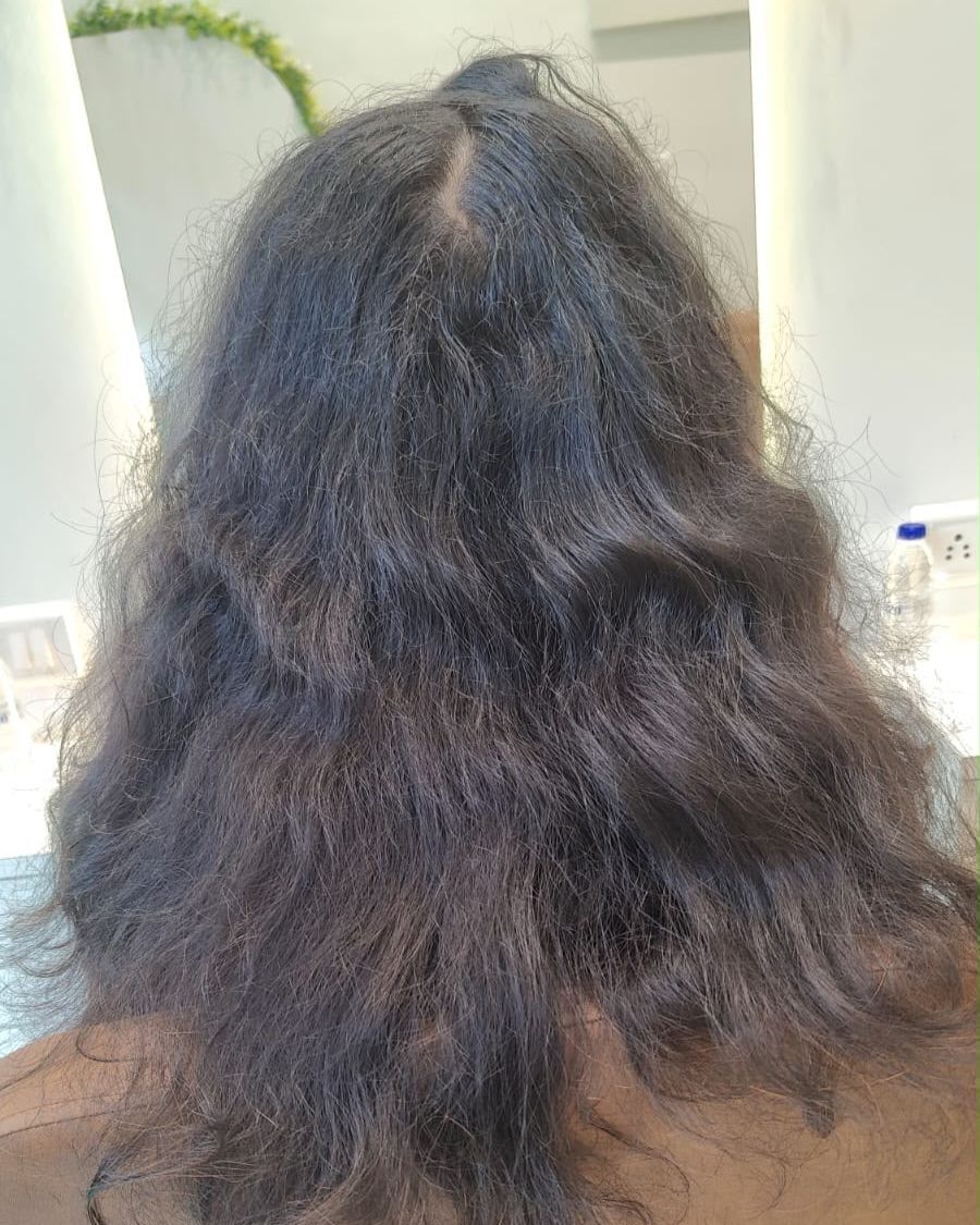 After